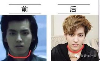 男网红整容脸吃瓜视频,吃瓜群众热议的整形真相